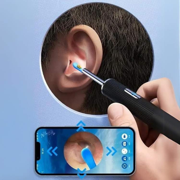 EarScope Pro Wax Removal Kit